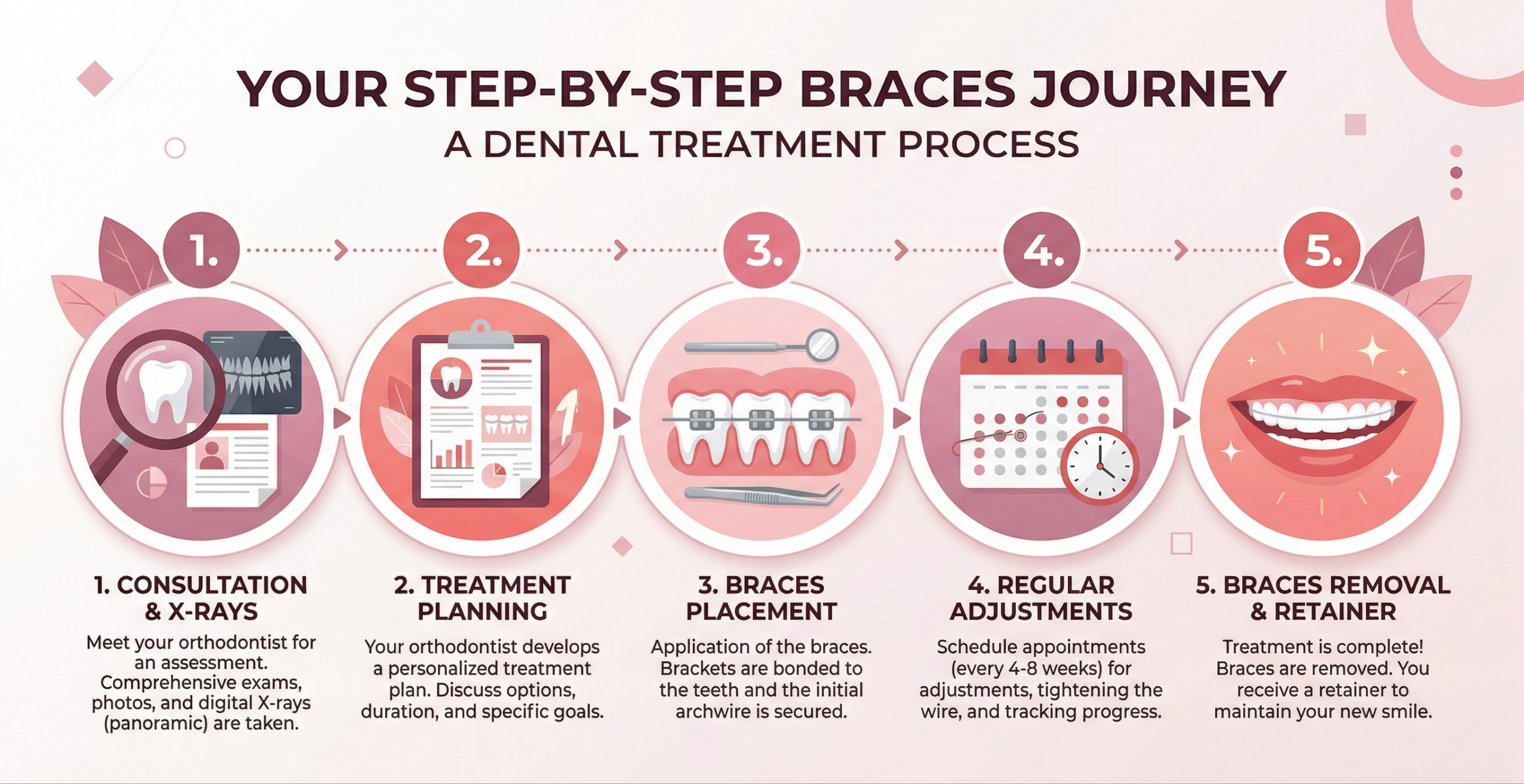 5-step dental braces treatment journey infographic: consultation, planning, placement, adjustments, removal and retainer
