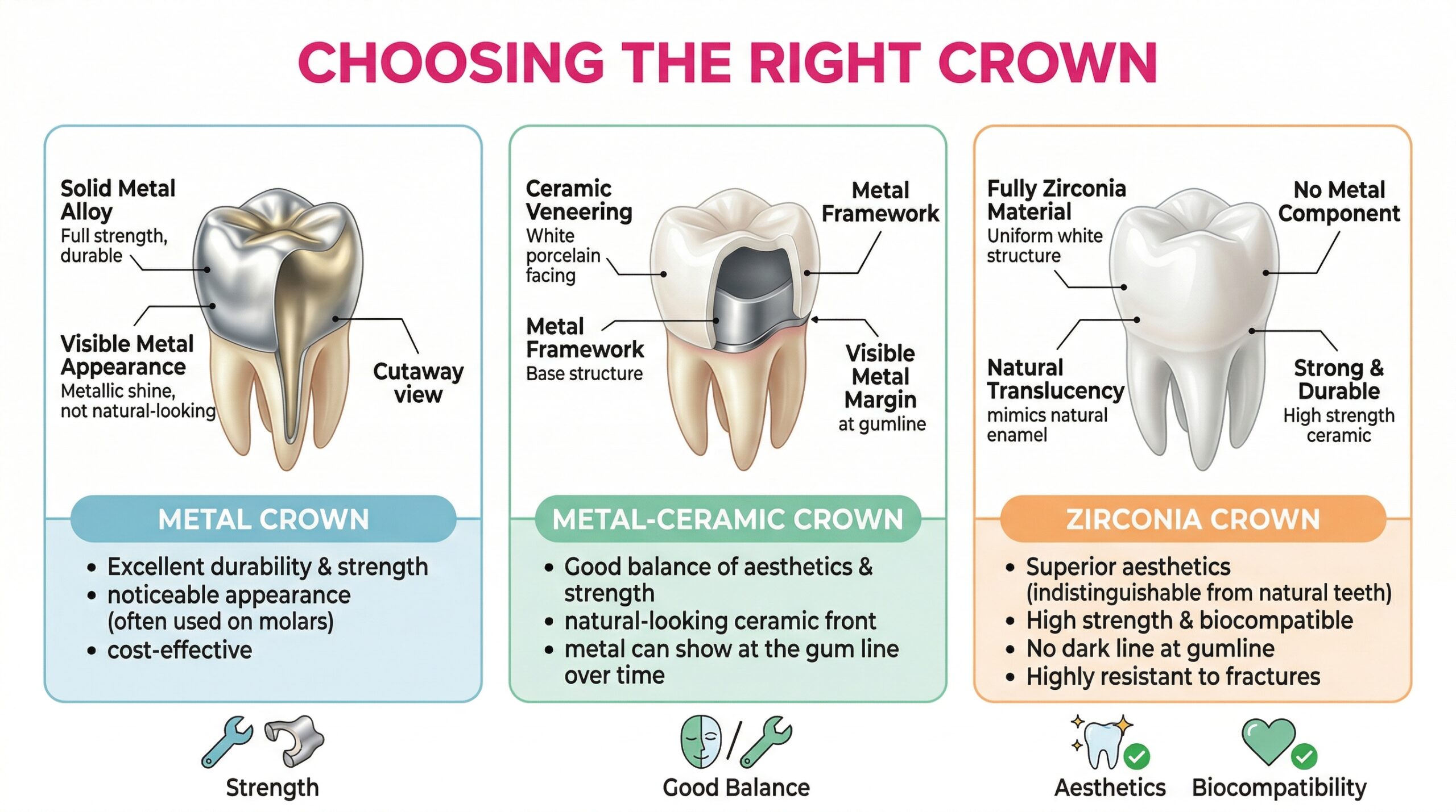 Infographic comparing metal crown, metal ceramic crown, and zirconia crown side by side