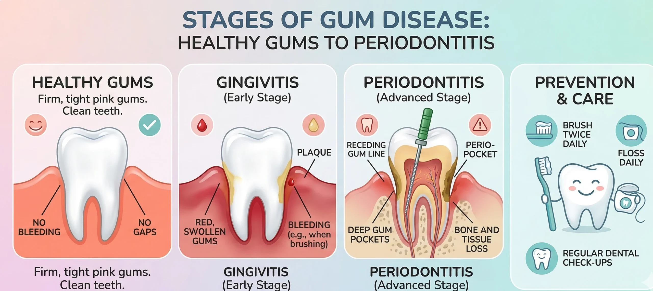 Stages of gum disease from healthy gums to periodontitis